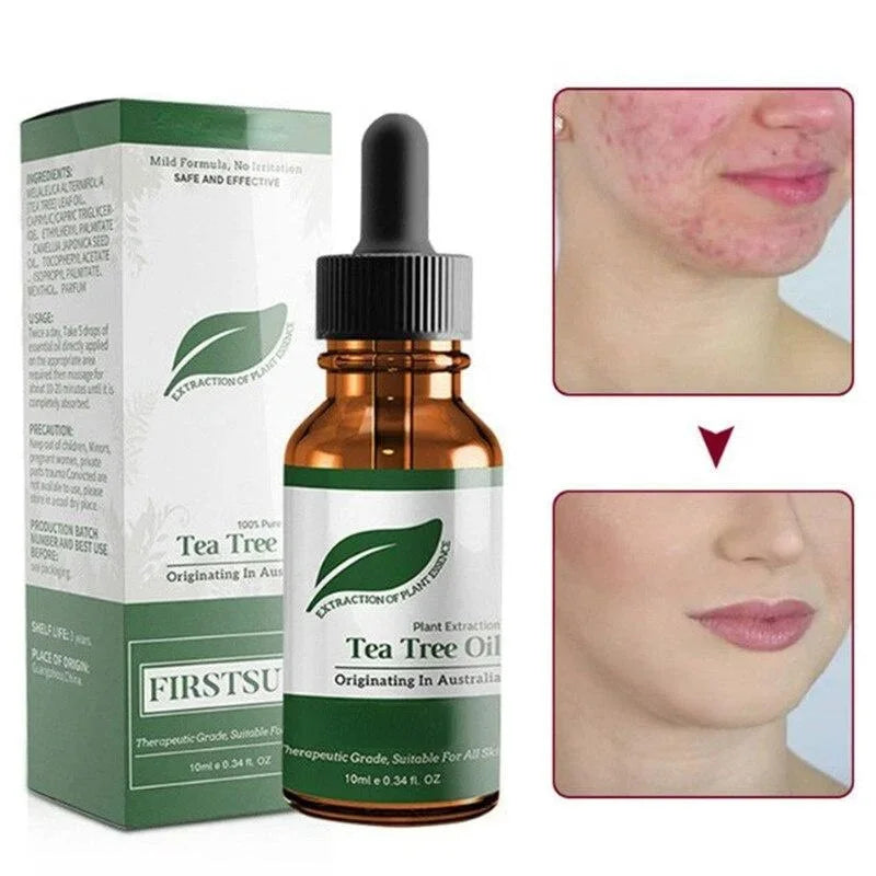 Tea Tree Oil Moisturizer