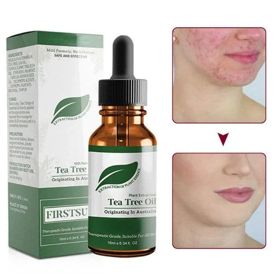 Tea Tree Oil Moisturizer